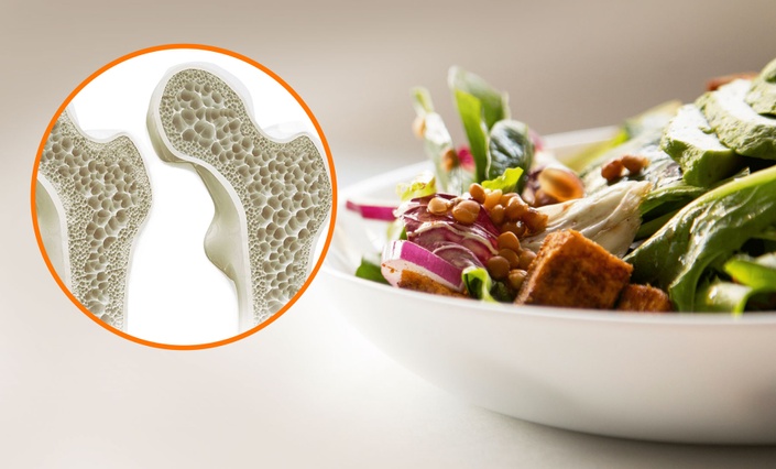 Osteoporosi: la prevenzione parte anche dalla tavola!